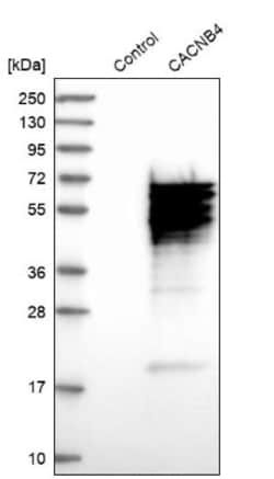 CACNB4 Antibody, Novus Biologicals 0.1mL; Unlabeled:Antibodies, Polyclonal